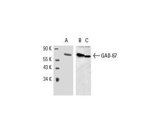 western blotting image from recommended GAD-67 (F-6) monoclonal antibody replacement. Image 9538