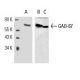 western blotting image from recommended GAD-67 (F-6) monoclonal antibody replacement. Image 9538
