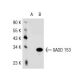 DDIT3/GADD153/CHOP Antibody (9C8) - Western Blotting - Image 37375 