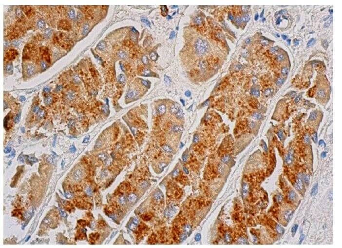 RRR3様 Y-3 - Y-3 | M AOP TRK TOP 3STRP / ブルゾン (メンズ