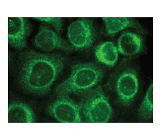 immunofluorescence image from recommended GADD 34 (B-10) monoclonal antibody replacement. Image 149296