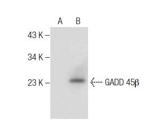 GADD 45&beta; Antibody (G-11) - Western Blotting - Image 283467SAM Transcription Activation: SAM system utilizing dCas9-VP64, MS2-P65-HSF1, and sgRNA for precise gene transcription activation. 