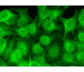 immunofluorescence image from recommended GADD 45&beta; (G-11) monoclonal antibody replacement. Image 370533