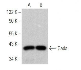 Gads Antibody (UW40) - Western Blotting - Image 368714 