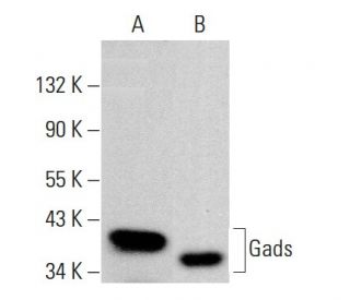 Gads Antibody (UW40) - Western Blotting - Image 382243Each CRISPR/Cas9 Knockout (KO) Plasmid product consists of a pool of 3 plasmids designed to ensure identification and cleavage of a specific gene for maximum knockout efficiency. Each plasmid encodes a unique 20 nt sequence derived from the GeCKO (v2) library.