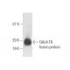 western blotting image from recommended GAL4-TA (A-2) monoclonal antibody replacement. Image 11002