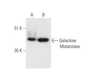 Galactose Mutarotase Antibody (C-4) - Western Blotting - Image 332754 