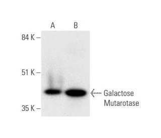 Galactose Mutarotase Antibody (E-4): sc-365556