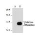 Galactose Mutarotase Antibody (G-7) - Western Blotting - Image 154676 