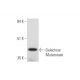 Galactose Mutarotase Antibody (G-7) - Western Blotting - Image 332771 