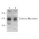 Galactose Mutarotase Antibody (G-7) - Western Blotting - Image 369371