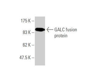 GALC Antibody (2D1) - Western Blotting - Image 348487