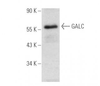 GALC Antibody (G-6) - Western Blotting - Image 390857Each CRISPR/Cas9 Knockout (KO) Plasmid product consists of a pool of 3 plasmids designed to ensure identification and cleavage of a specific gene for maximum knockout efficiency. Each plasmid encodes a unique 20 nt sequence derived from the GeCKO (v2) library.