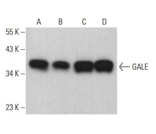 GALE Antibody (D-11) - Western Blotting - Image 378506 
