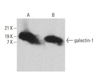 galectin-1 Antibody (E-2) - Western Blotting - Image 380768 