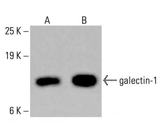galectin-1 Antibody (C-8) - Western Blotting - Image 413618