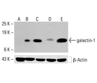 galectin-1 Antibody (B-2) - Western Blotting - Image 413617