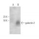 galectin-2 Antibody (C6) - Western Blotting - Image 374570