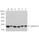 This polyclonal antibody has been discontinued. See our recommended <a href="galectin-3-antibody-b2c10">galectin-3 (B2C10)</a> monoclonal antibody (sample data shown). western blotting image from recommended galectin-3 (B2C10) monoclonal antibody replacement. Image 353171