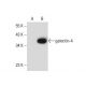 galectin-4 Antibody (B-9) - Western Blotting - Image 133868