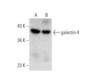 galectin-4 Antibody (B-9) - Western Blotting - Image 319526 