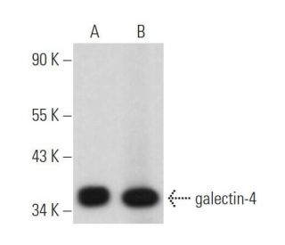 western blotting image from recommended galectin-4 (D-11) monoclonal antibody replacement. Image 374462