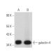 western blotting image from recommended galectin-4 (D-11) monoclonal antibody replacement. Image 374462