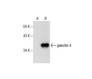 galectin-4 Antibody (F-1) - Western Blotting - Image 157513