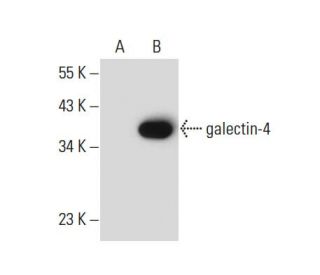 galectin-4 Antibody (B-9) - Western Blotting - Image 133868 