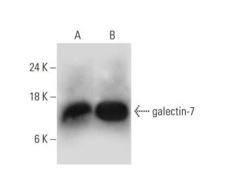 galectin-7 Antibody (D-5) - Western Blotting - Image 325101 