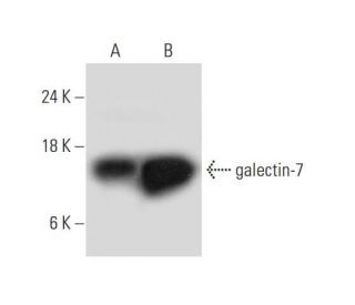 galectin-7 Antibody (H-8) - Western Blotting - Image 325102 