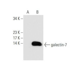 galectin-7 Antibody (H-8) - Western Blotting - Image 68579 