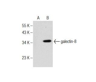 galectin-8 Antibody (C-8) - Western Blotting - Image 281806