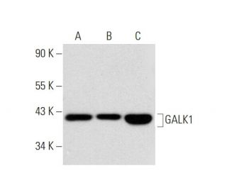 GALK1 Antibody (A-2) - Western Blotting - Image 296224 