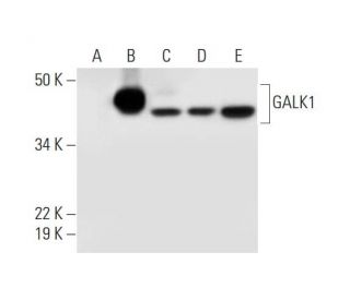 GALK1 Antibody (C-1) - Western Blotting - Image 294772 