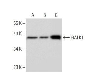 GALK1 Antibody (F-3) - Western Blotting - Image 304927 