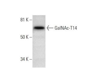GalNAc-T14 Antibody (A-8) - Western Blotting - Image 291943 