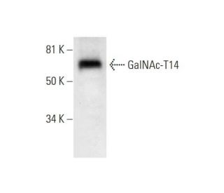 GalNAc-T14 Antibody (C-5) - Western Blotting - Image 292005 