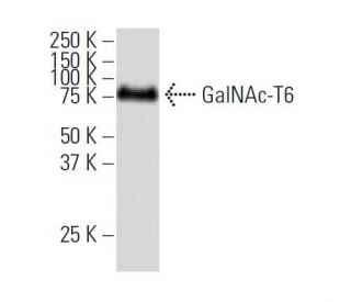 GalNAc-T6 Antibody (Y5J) - Western Blotting - Image 34129 