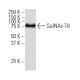 GalNAc-T6 Antibody (Y5J) - Western Blotting - Image 34129 