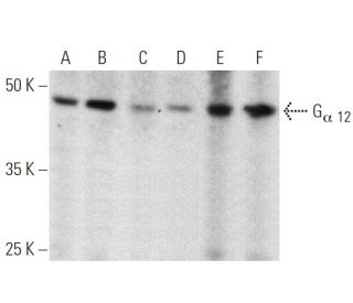 western blotting image from recommended Gα 12 (E-12) monoclonal antibody replacement. Image 360093