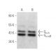 This polyclonal antibody has been discontinued. See our recommended <a href="galpha-s-olf-antibody-a-5">G<sub>α s/olf</sub> (A-5)</a> monoclonal antibody (sample data shown). western blotting image from recommended Gα s/olf (A-5) monoclonal antibody replacement. Image 14618