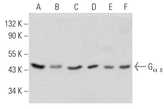 galpha-s-antibody-12-western-