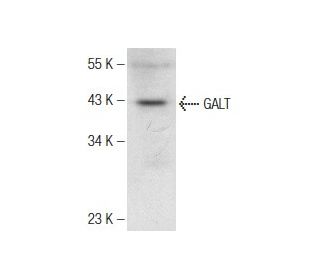 GALT Antibody (G-1) - Western Blotting - Image 142616 