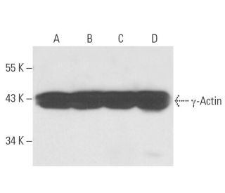&gamma;-Actin Antibody (2-2) - Western Blotting - Image 16454 