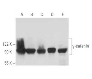 &gamma;-catenin Antibody (11E4) - Western Blotting - Image 357670 