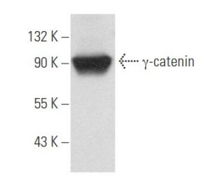 &gamma;-catenin Antibody (15F11) - Western Blotting - Image 357669 