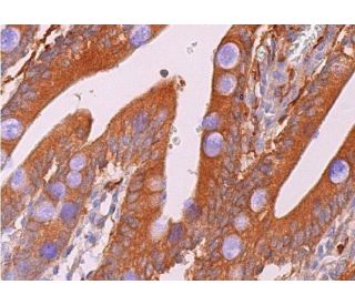 &gamma;-GCSc Antibody (H-5) - Immunohistochemistry - Image 368910 