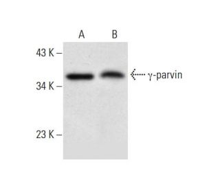 &gamma;-parvin Antibody (A-11) - Western Blotting - Image 300458 