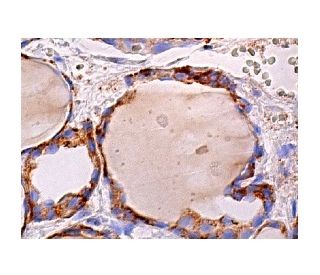 &gamma;-parvin Antibody (B-9) - Immunohistochemistry - Image 158582 
